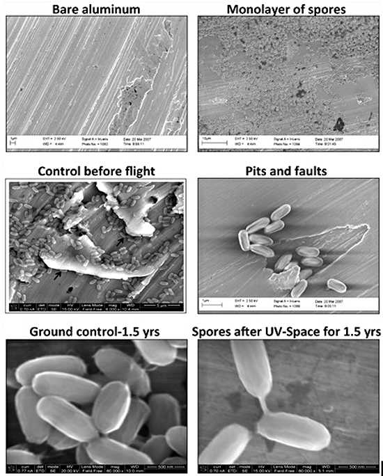 bacillus